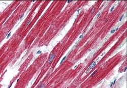 Leptin R Antibody, Novus Biologicals 0.1mg; Unlabeled:Antibodies, Polyclonal