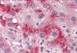 Leptin R Antibody, Novus Biologicals 0.1mg; Unlabeled:Antibodies, Polyclonal