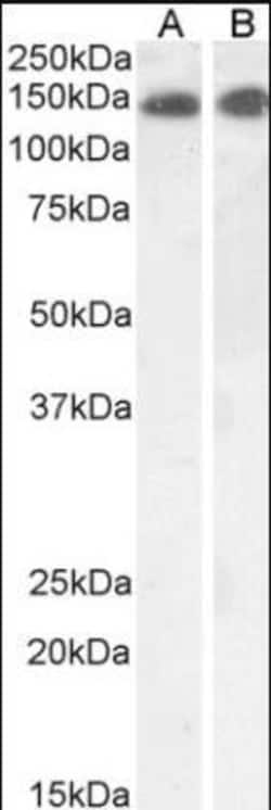 Leptin R Antibody, Novus Biologicals 0.1mg; Unlabeled:Antibodies, Polyclonal