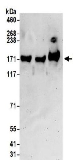 Leucyl-cystinyl Aminopeptidase/LNPEP Antibody, Novus Biologicals 0.1mg;
