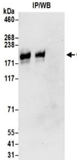 Leucyl-cystinyl Aminopeptidase/LNPEP Antibody, Novus Biologicals 0.1mg;