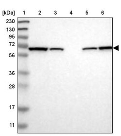 Leukotriene A4 Hydrolase/LTA4H Antibody, Novus Biologicals 0.1mL; Unlabeled:Antibodies