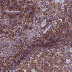 Leupaxin Antibody, Novus Biologicals 0.1mL; Unlabeled:Antibodies, Polyclonal