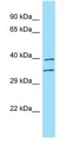 Fucosyltransferase 3/FUT3 Antibody, Novus Biologicals 100&mu;L; Unlabeled:Antibodies,
