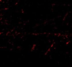 Lgi1 Antibody - BSA Free, Novus Biologicals 0.1mg; Unlabeled:Antibodies,