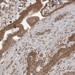 Lgl1 Antibody, Novus Biologicals 25 &mu;L; Unlabeled:Antibodies, Polyclonal