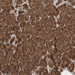 Lgl1 Antibody, Novus Biologicals 0.1mL; Unlabeled:Antibodies, Polyclonal