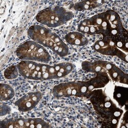 Lipin 2 Antibody, Novus Biologicals:Antibodies:Primary Antibodies