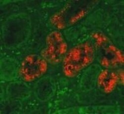Lipocalin-2/NGAL Antibody (29) - BSA Free, Novus Biologicals 0.1 mg; Unconjugated:Antibodies,