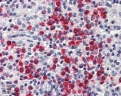Lipocalin-2/NGAL Antibody, Novus Biologicals 0.1mg; Unlabeled:Antibodies,
