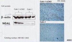 Lipocalin-2/NGAL Antibody, Novus Biologicals 0.1mg; Unlabeled:Antibodies,