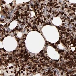 Lipocalin-2/NGAL Antibody, Novus Biologicals 25 &mu;L; Unlabeled:Antibodies,