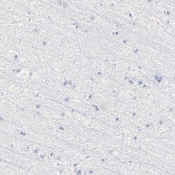 Lipocalin-2/NGAL Antibody, Novus Biologicals 25 &mu;L; Unlabeled:Antibodies,