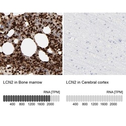 Lipocalin-2/NGAL Antibody, Novus Biologicals 25 &mu;L; Unlabeled:Antibodies,