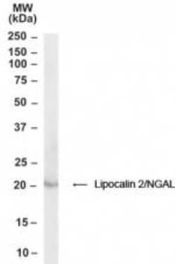 Lipocalin-2/NGAL Antibody, Novus Biologicals 0.1mg; Unlabeled:Antibodies,