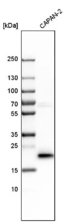 Lipocalin-2/NGAL Antibody, Novus Biologicals 25 &mu;L; Unlabeled:Antibodies,