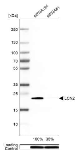 Lipocalin-2/NGAL Antibody, Novus Biologicals 25 &mu;L; Unlabeled:Antibodies,