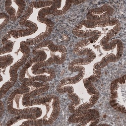 Lipolysis Stimulated Lipoprotein Receptor Antibody, Novus Biologicals:Antibodies:Primary