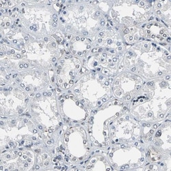 Lipolysis Stimulated Lipoprotein Receptor Antibody, Novus Biologicals:Antibodies:Primary
