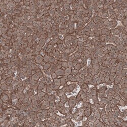Lipolysis Stimulated Lipoprotein Receptor Antibody, Novus Biologicals:Antibodies:Primary
