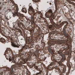 Lipolysis Stimulated Lipoprotein Receptor Antibody, Novus Biologicals:Antibodies:Primary