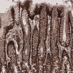 Lipolysis Stimulated Lipoprotein Receptor Antibody, Novus Biologicals:Antibodies:Primary