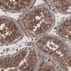 Lipolysis Stimulated Lipoprotein Receptor Antibody, Novus Biologicals:Antibodies:Primary
