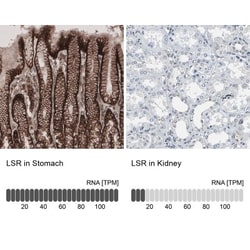 Lipolysis Stimulated Lipoprotein Receptor Antibody, Novus Biologicals:Antibodies:Primary