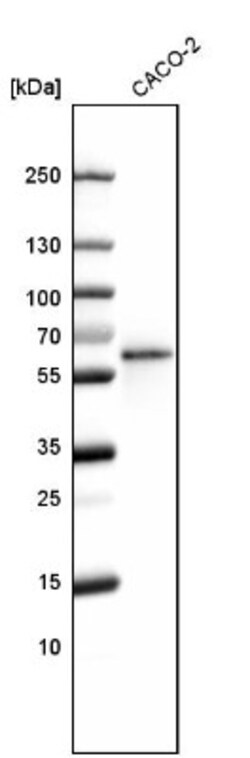 Lipolysis Stimulated Lipoprotein Receptor Antibody, Novus Biologicals:Antibodies:Primary