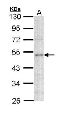 Lipoprotein Lipase/LPL Antibody, Novus Biologicals 0.1mL; Unlabeled:Antibodies,