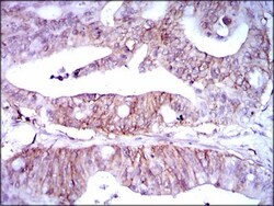 Lipoprotein a Antibody (4H1) - BSA Free, Novus Biologicals:Antibodies:Primary