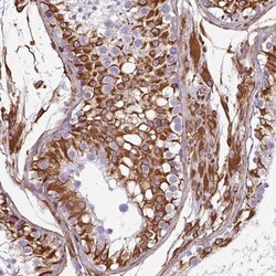 Liprin alpha 1 Antibody, Novus Biologicals 25 &mu;L, Unlabeled:Antibodies,