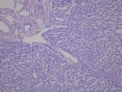 Novus Biologicals&trade;&nbsp;Liver Tissue Slides (Liver Cirrhosis)- Paraffin