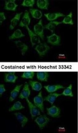 Loricrin Antibody, Novus Biologicals 0.1mL; Unlabeled:Antibodies, Polyclonal