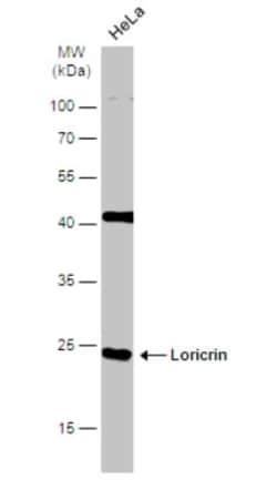 Loricrin Antibody, Novus Biologicals 0.1mL; Unlabeled:Antibodies, Polyclonal