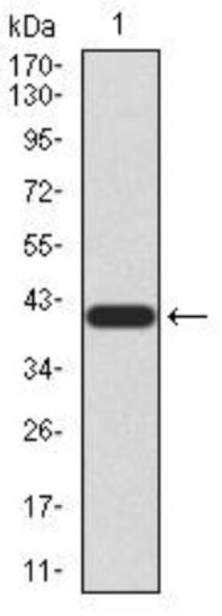LRP-1 Antibody (1F6C6) - BSA Free, Novus Biologicals 0.025 mg | Buy Online | Novus Biologicals | Fisher Scientific