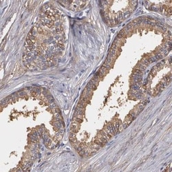 Lumican Antibody, Novus Biologicals 0.1mL; Unlabeled:Antibodies, Polyclonal
