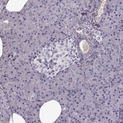 Lumican Antibody, Novus Biologicals 0.1mL; Unlabeled:Antibodies, Polyclonal