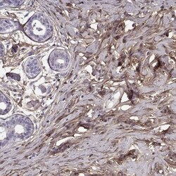 Lumican Antibody, Novus Biologicals 0.1mL; Unlabeled:Antibodies, Polyclonal