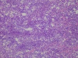 Novus Biologicals Lung Matched Primary Tumor and Metastatic Tumor Slides - Frozen 10 portaobjetos | Buy Online | Novus Biologicals&trade; | Fisher Scientific