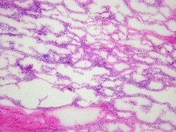 Novus Biologicals Lung Tissue Slides (Diabetes)- Frozen 5 portaobjetos | Buy Online | Novus Biologicals&trade; | Fisher Scientific