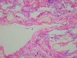 Novus Biologicals Lung Tissue Slides (Emphysema)- Frozen 5 Slides | Buy Online | Novus Biologicals&trade; | Fisher Scientific