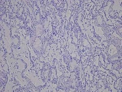 Novus Biologicals Lung Tissue Slides (Emphysema)- Paraffin 5 Slides | Buy Online | Novus Biologicals&trade; | Fisher Scientific