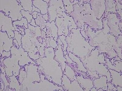 Novus Biologicals Lung Tissue Slides (Liver Cirrhosis)- Paraffin 5 Slides | Buy Online | Novus Biologicals&trade; | Fisher Scientific