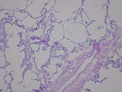 Novus Biologicals Lung Tissue Slides (Lupus)- Paraffin 5 Objektträger | Buy Online | Novus Biologicals&trade; | Fisher Scientific