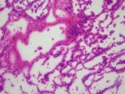 Novus Biologicals Lung Tissue Slides (Pneumonia)- Frozen 5 Slides | Buy Online | Novus Biologicals&trade; | Fisher Scientific