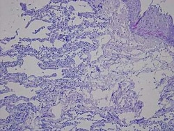 Novus Biologicals Lung Tissue Slides (Pulmonary Embolism)- Paraffin 5 Slides | Buy Online | Novus Biologicals&trade; | Fisher Scientific