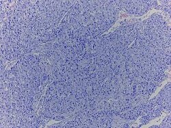 Novus Biologicals Lung Tissue Slides (Squamous Cell Carcinoma)- Paraffin 5 Slides | Buy Online | Novus Biologicals&trade; | Fisher Scientific