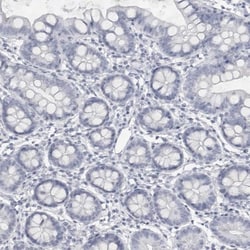 Ly-6D Antibody, Novus Biologicals 25 &mu;L; Unlabeled:Antibodies, Polyclonal