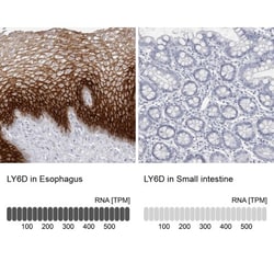 Ly-6D Antibody, Novus Biologicals 25 &mu;L; Unlabeled:Antibodies, Polyclonal